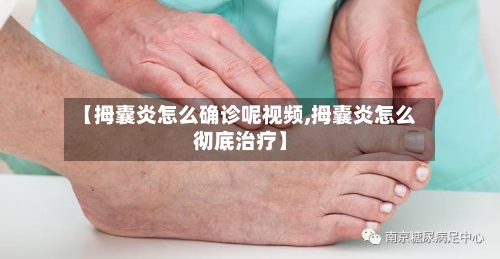 【拇囊炎怎么确诊呢视频,拇囊炎怎么彻底治疗】
