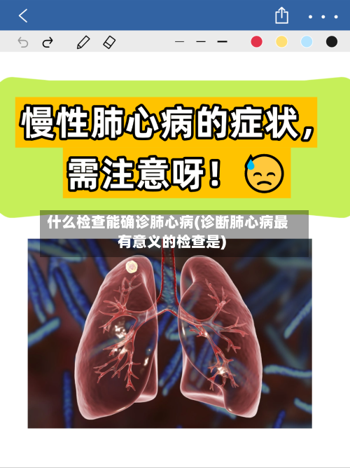 什么检查能确诊肺心病(诊断肺心病最有意义的检查是)